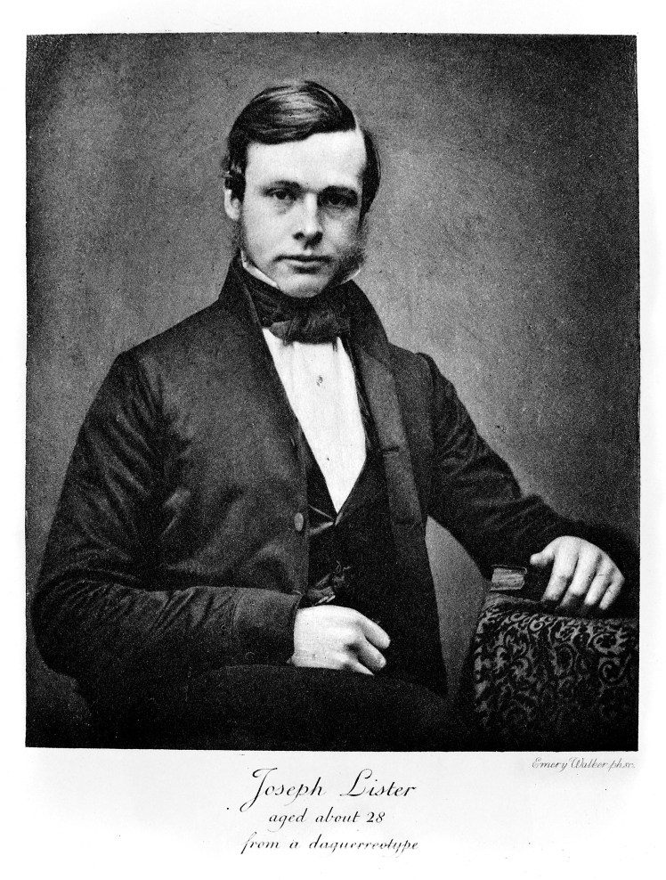M0006512 Joseph Lister, 1st Baron Lister [1827  1912] surgeon